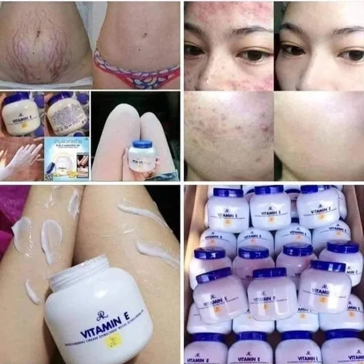 vit e moisturizing cream