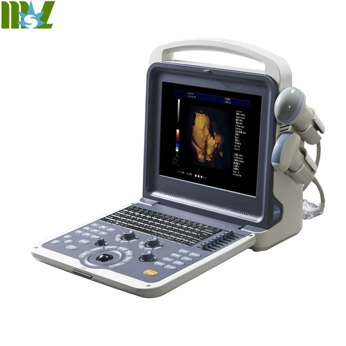 at home ultrasound machine for phone