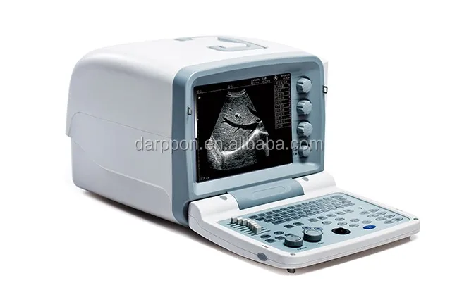 Portable Echo Ultrasound/cardiac Ultrasound Equipment/ultrasound