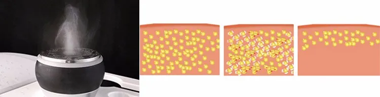 Cavitation Anatomy