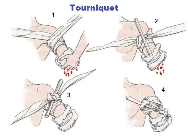 tourniquet latex-free disposable blue rolled