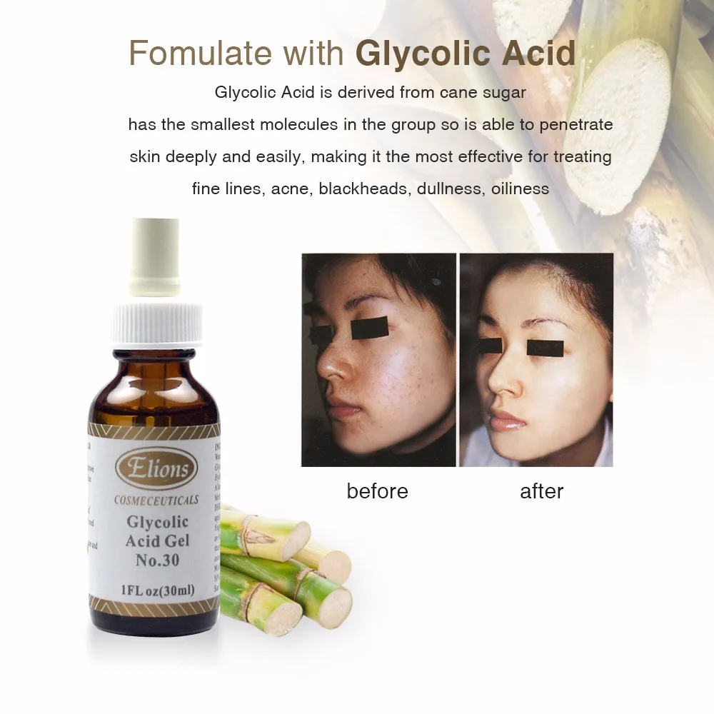 Glycolic Acid 30 Chemical Peel For Face Whitening Peeling Gel Aha