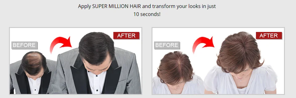 Super million hair