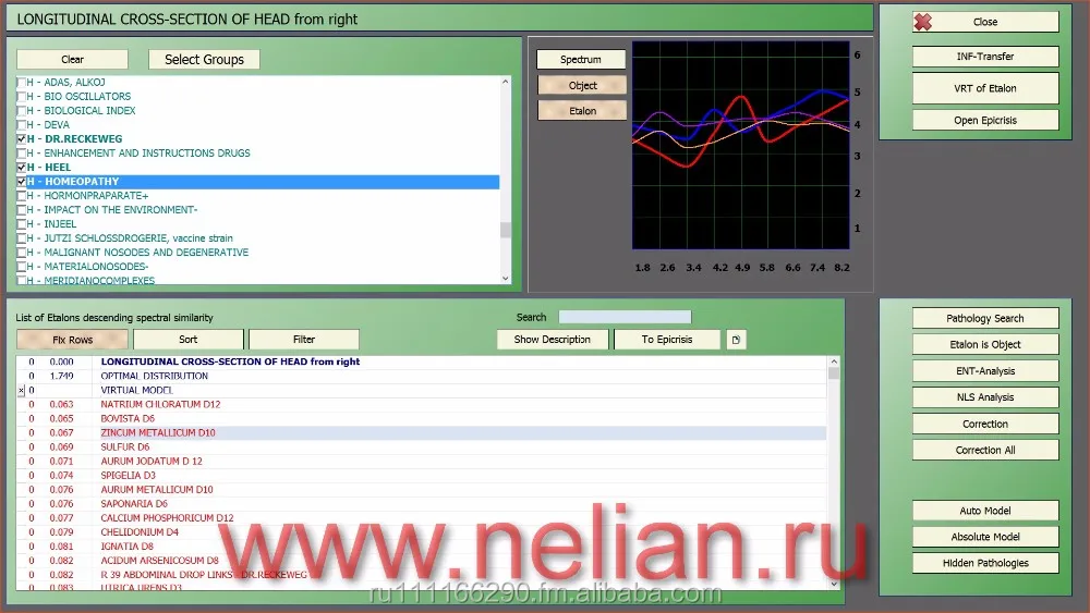 
Dianel-5122 9D NLS diagnostic health analyzer machine with VRT-test for medicine 