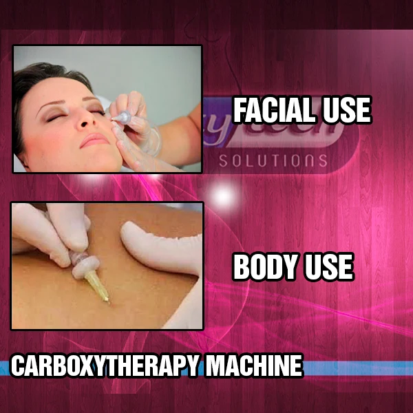
CarboxyTherapy - Wrinkle, Body Fat & Cellulite Removal! 
