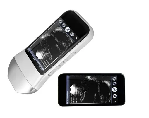 SIFULTRAS-5.4 Linear Built-in Screen Ultrasound Scanner-4.jpeg