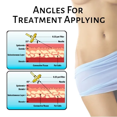 
Carboxiterapy Machine CO2 Treatment Erectile Dysfunction Vascular Lesions Hair Growth Acne 