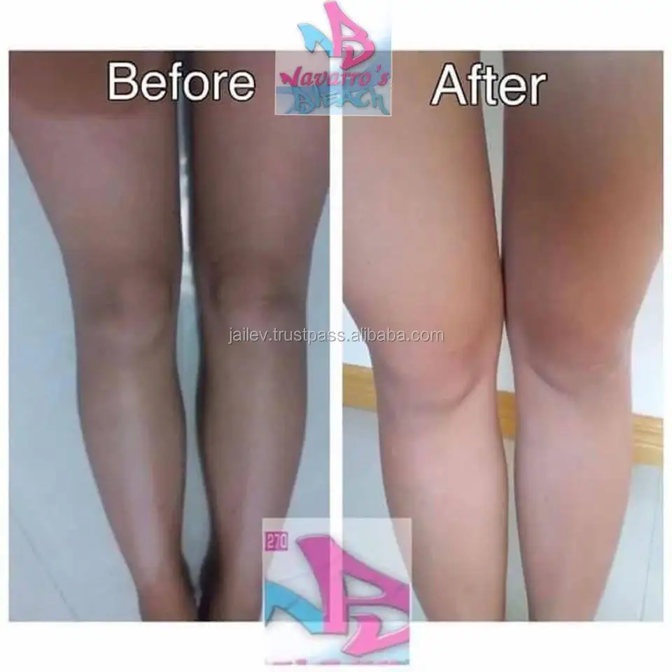 Whitening Navarro S Bleaching Set Powder Solution Buy Bleaching Set Msds Bleaching Powder Uses Bleaching Powder Product On Alibaba Com whitening navarro s bleaching set powder solution buy bleaching set msds bleaching powder uses bleaching powder product on alibaba com