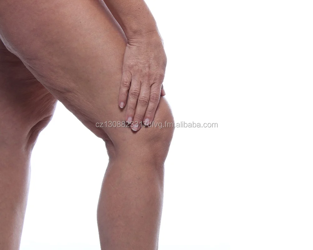 
SwissMedicus SwissGel FORTE extra strong warming Herbal balsam, Swiss quality 