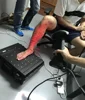 Fast handheld high accuracy eye-safe class laser 3d scanner in healthcare