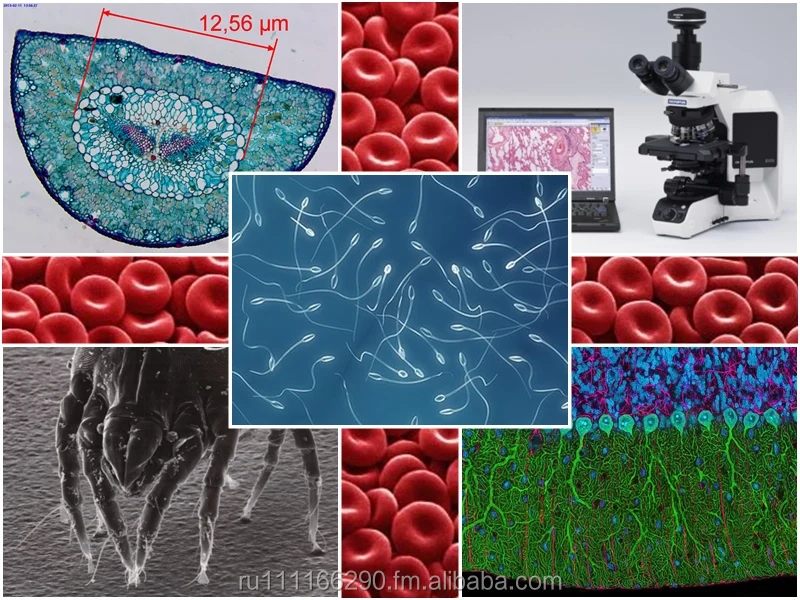
Dianel-Micro-software for automation,visualization,classification and evaluation of laboratory researches on digital microscope 