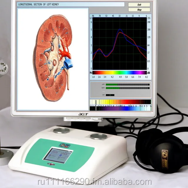 Диагностики 9. NLS диагностика аппарат. Биолаз Оберон Дианел про. Дианел аппарат. Диагностическое обследование организма.
