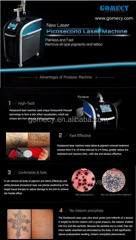 Picosure laser pico remove tattoo vertical machine.jpg