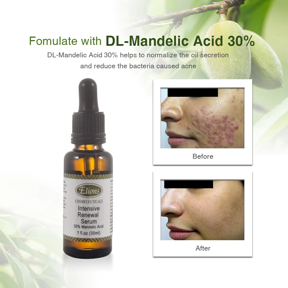 30 Mandelic Acid Anti Acne Pimple Face Peel Licorice Aha Serum Buy