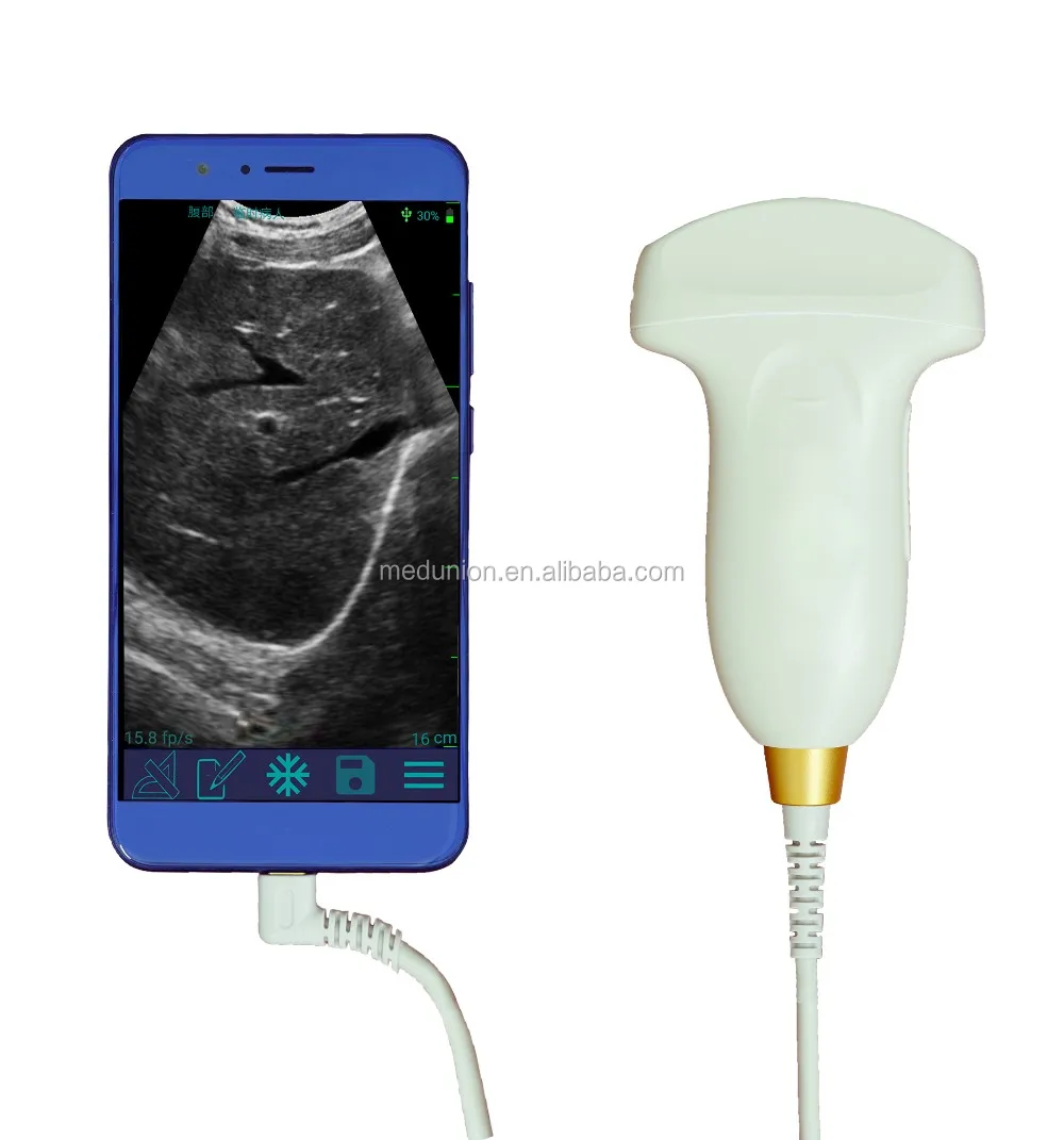 128 Element Usb Ultrasound Equipment Convex Probe Gynecology,Urology Buy Gynecology Urology