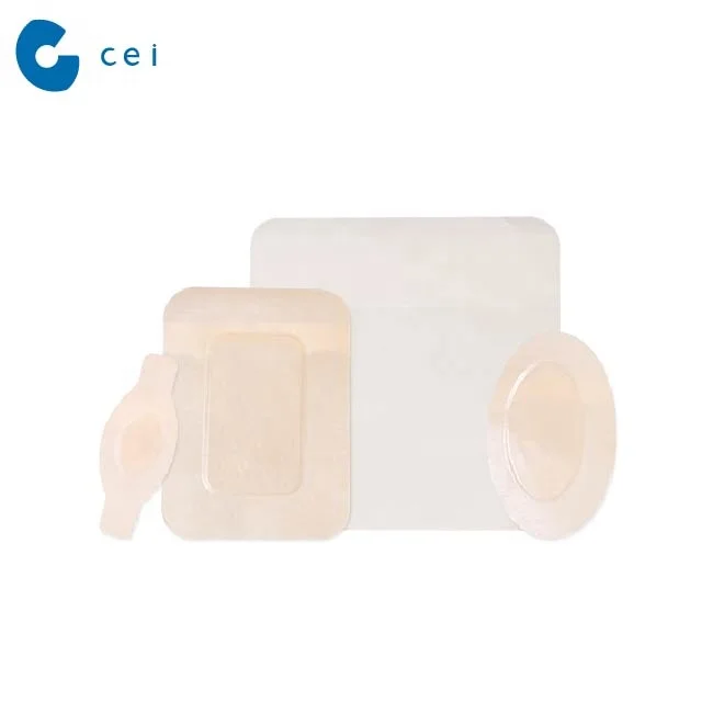 Medical Consumables Hydrocolloid Adhesive Tape Hydrocolloid Wound