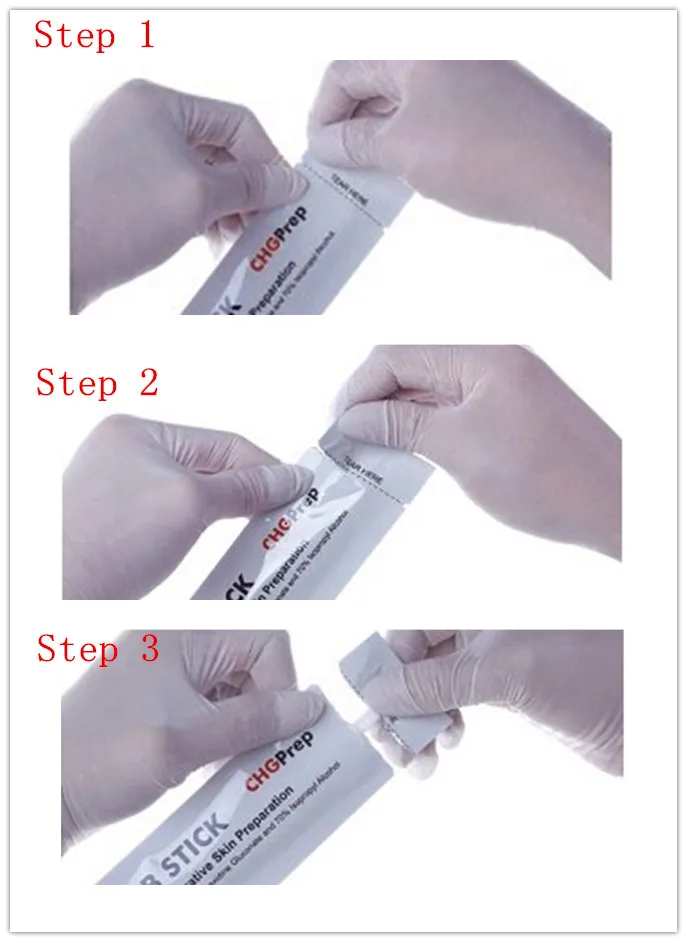 CHG swab