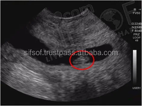convex-ultrasound.jpg
