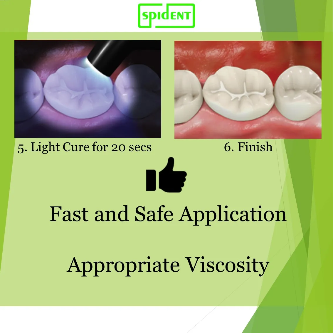 Dental Light Cured Sealants For Enamel Pit And Fissure Buy Pit And Fissure Sealants,Light