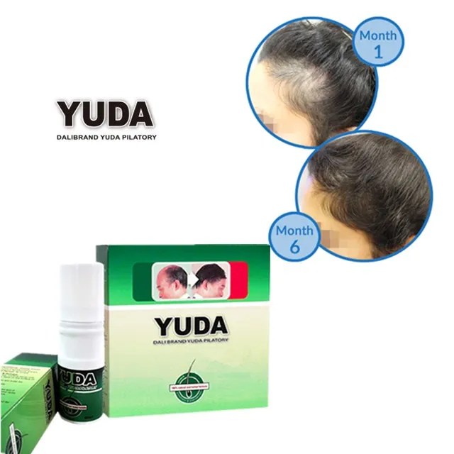 

Hair Fall Solution With Best Hair Loss Treatment for Men Yuda Hair Care Product