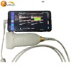 Color Flow Function USB Probe 128 Elements Wireless Ultrasound Linear Probe