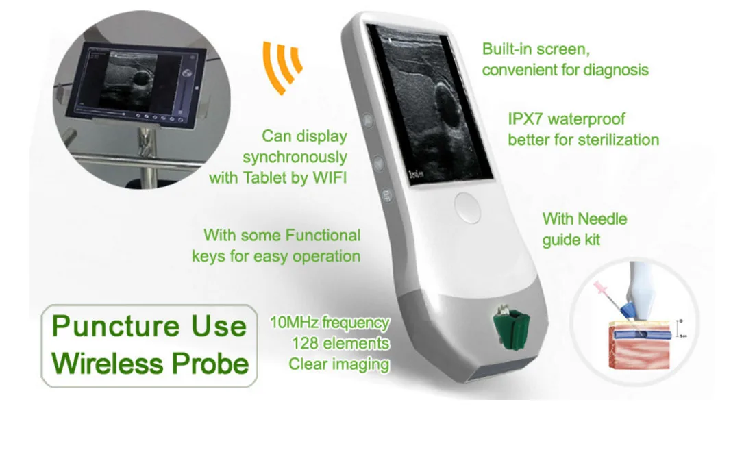 Pocket Wireless Ultrasound Scanner With Built In Screen For Breast 8