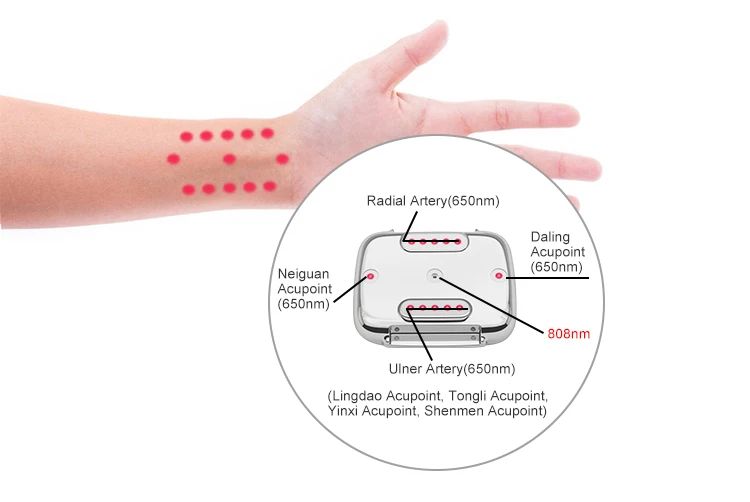 Exclusive private mold 650nm+808nm red light wrist type laser watch  for pain relief  rhinitis  hypertension sugar diabets