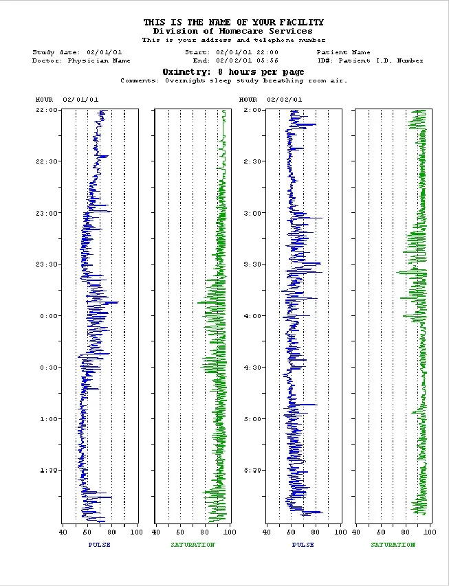 
ProFox Respiratory & Oximetry Software 