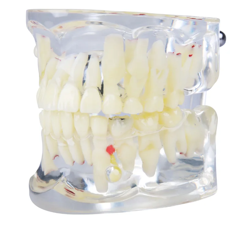 Core crowns
