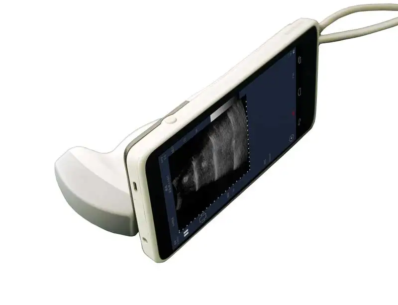 Pemindai Ultrasound Convex Doppler Warna USB 2-5 MHz