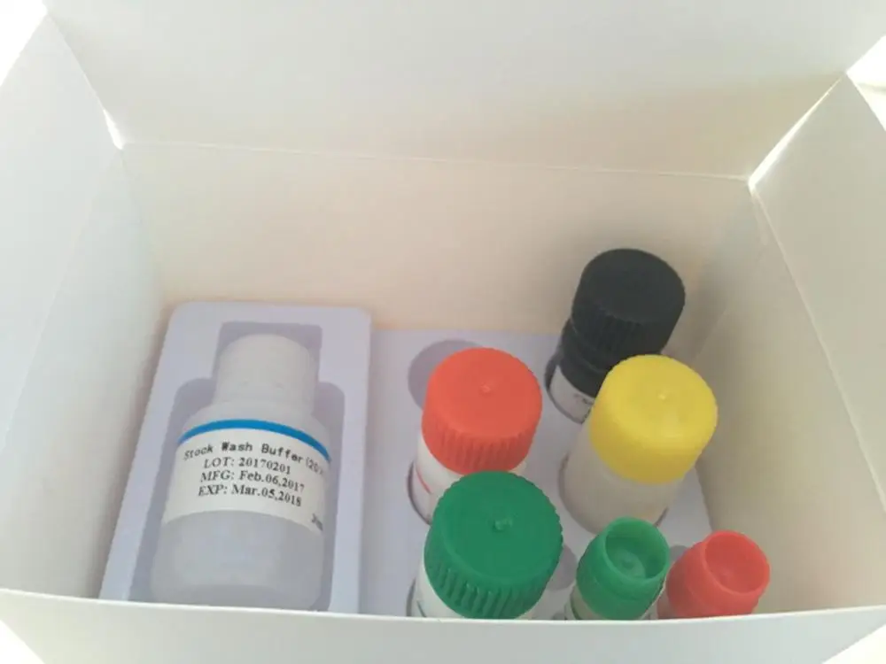 Immunoassay Hiv 1+2,Htlv,Hbv,Tbigra,Vd3,Pth Elisa Reagent Kit/elisa