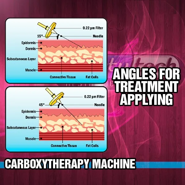 
Top Quality CarboxyTherapy - Effective Rejuvenation and Lifting! 