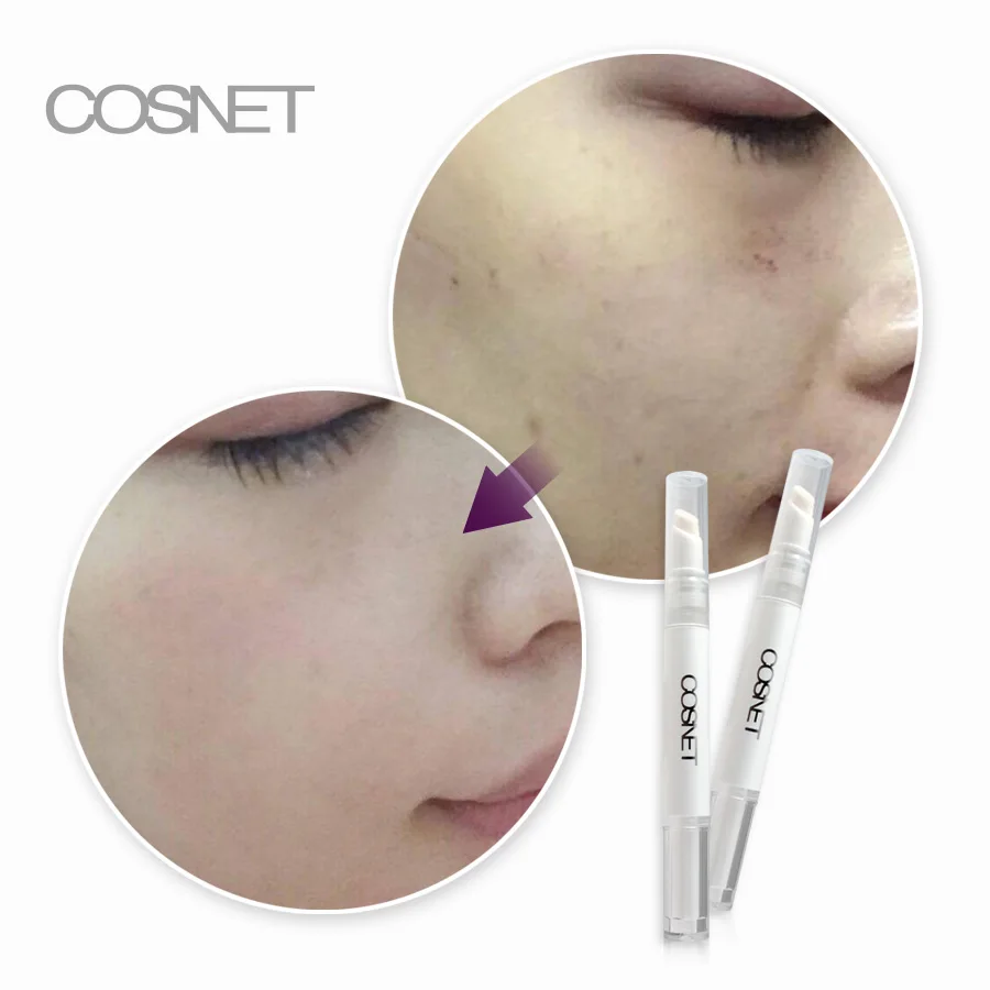 dark spots remove serum 04