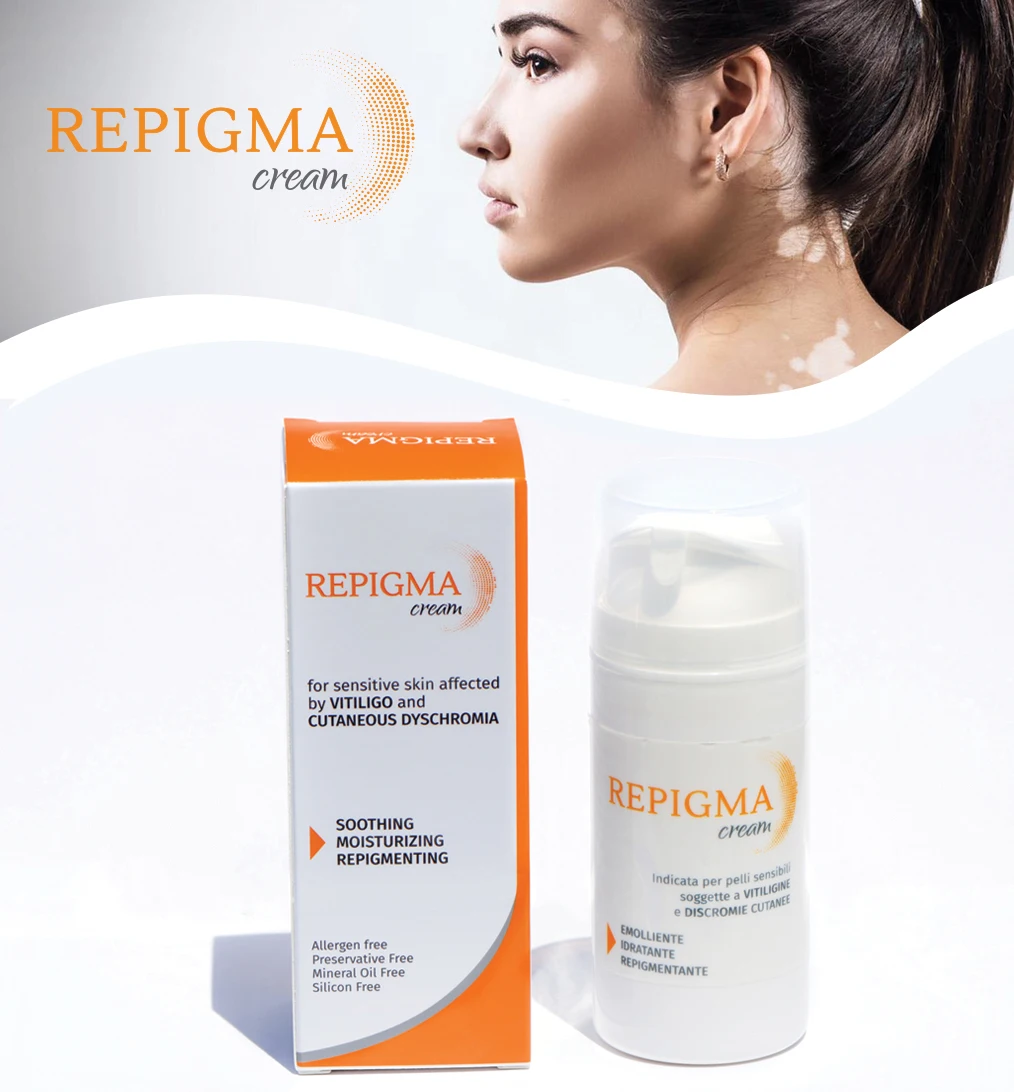 Natural And Vegan Body Cream To Support Vitiligo And Skin Pigmentation Disorders Treatment For