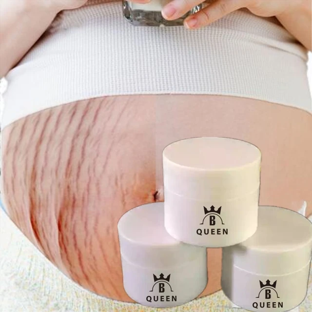 

Top Quality Cream for Black Spots and Stretch Mark Removal with Private Label