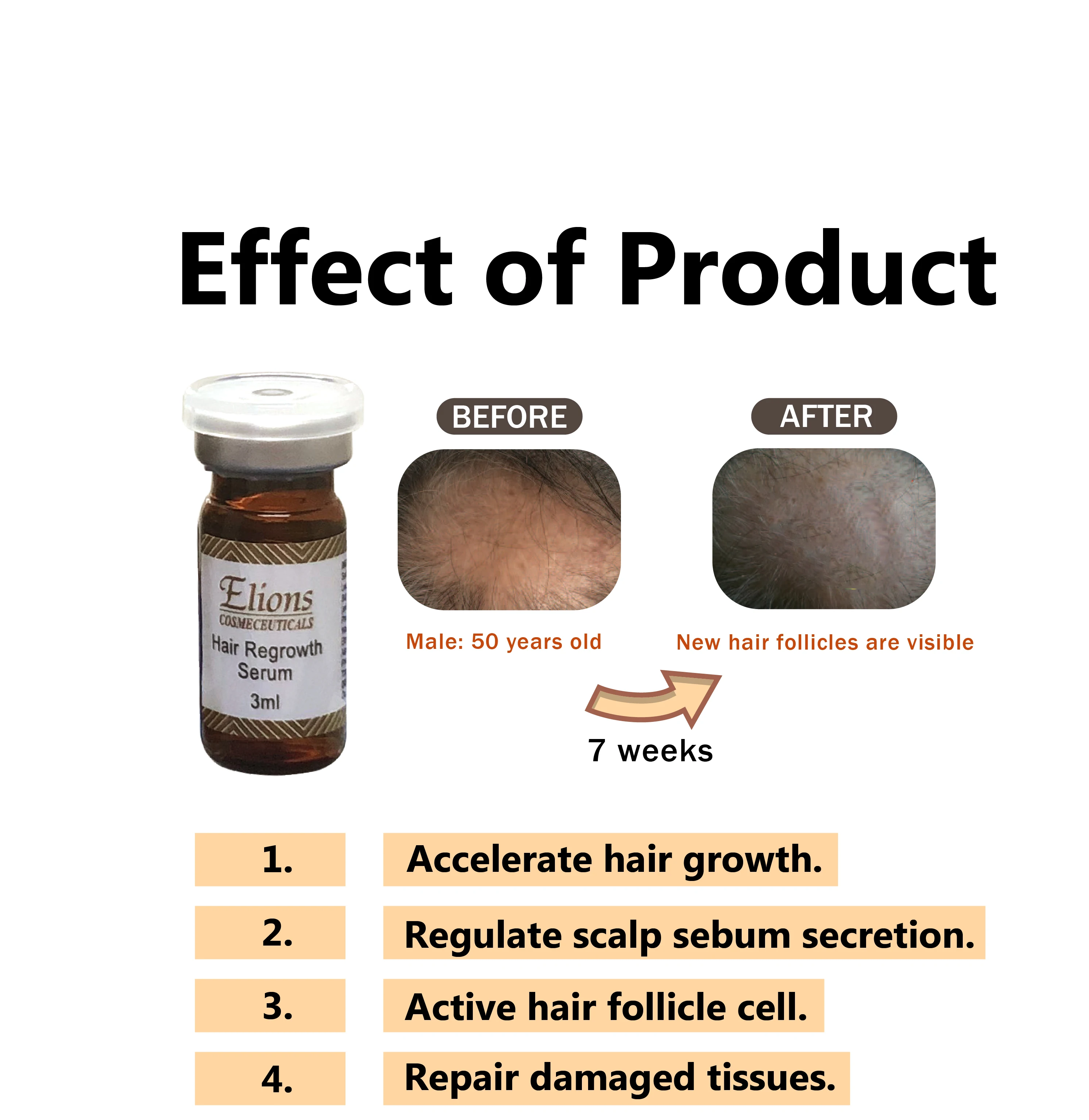 hair loss stopper
