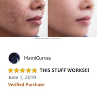 Anti-Acne Cream 5.jpg