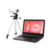 Portable digital colposcope with sony color digital CCD, 800000 pixel MSLCE02
