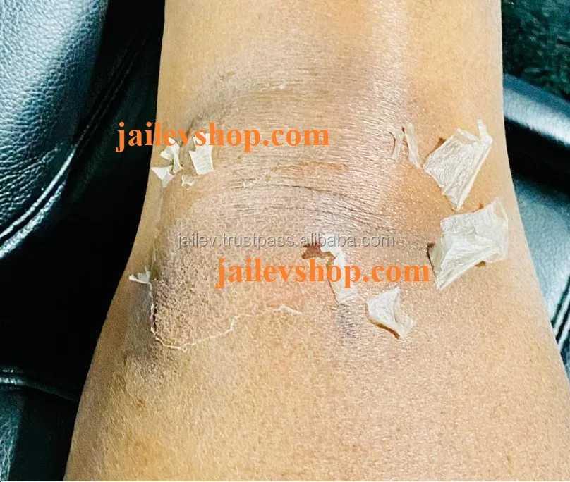 lightened knees 2.jpg