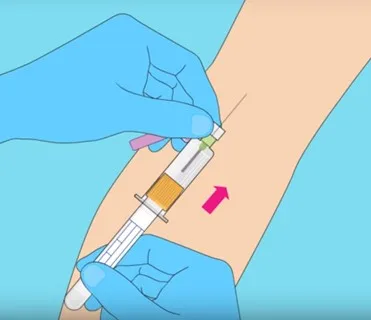 bd vacutainer eclipse采血针21号1-1/4-368650 - buy vacutainer