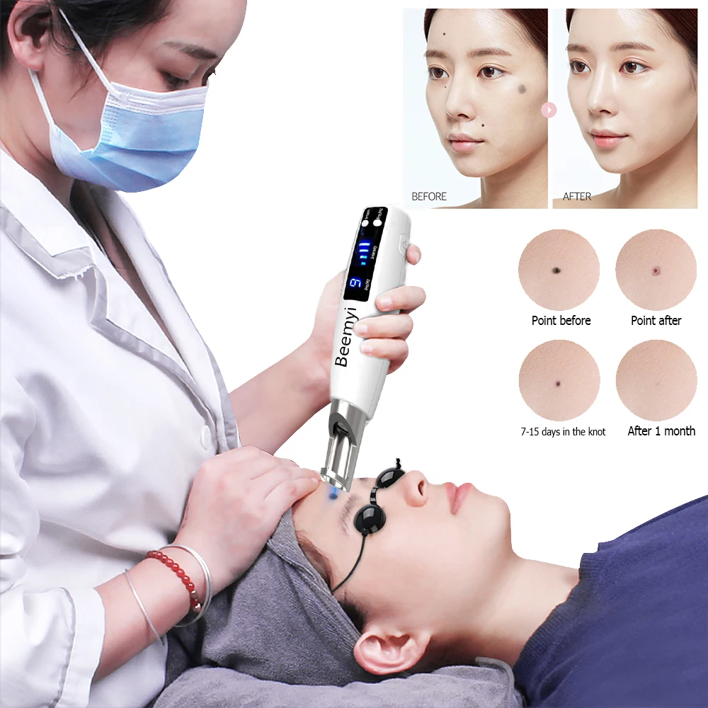 

New Design Portable Blue Red Light Therapy USB Rechargeable Mole Removal Tattoo Removal Picosecond Laser Pen