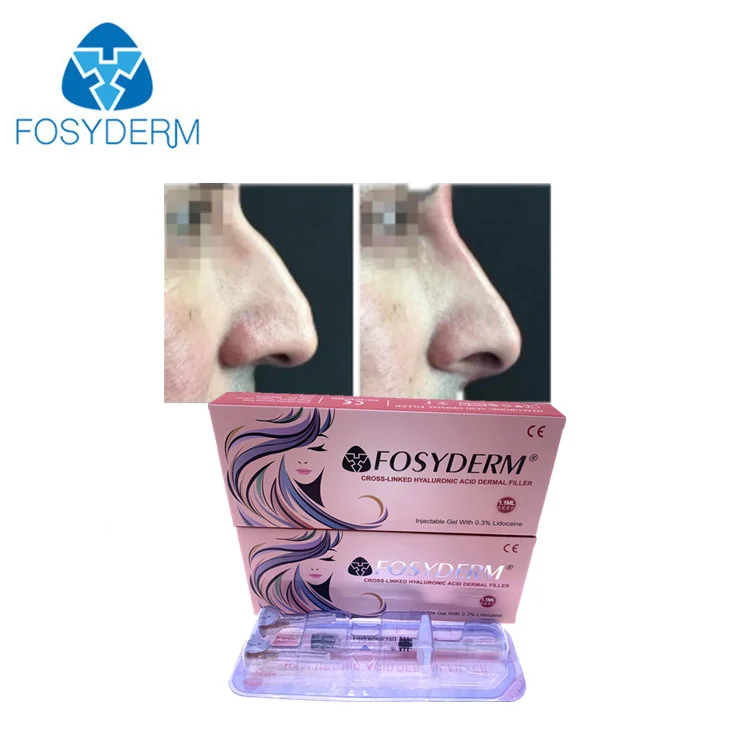 

Fosyderm 1ml Deep Cross linked Hyaluronic Acid Injectable Dermal Fillers 24mg/ml